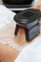 Non-lnvasive Lipolysis