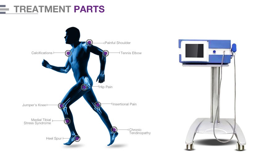 Newangie Soft Shockwave Knee Therapy Machine Pain Stem Cell