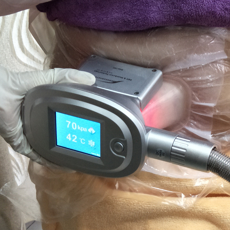Cryolipolysis Fat Freeze Machine for Sale Manufacturer Supply