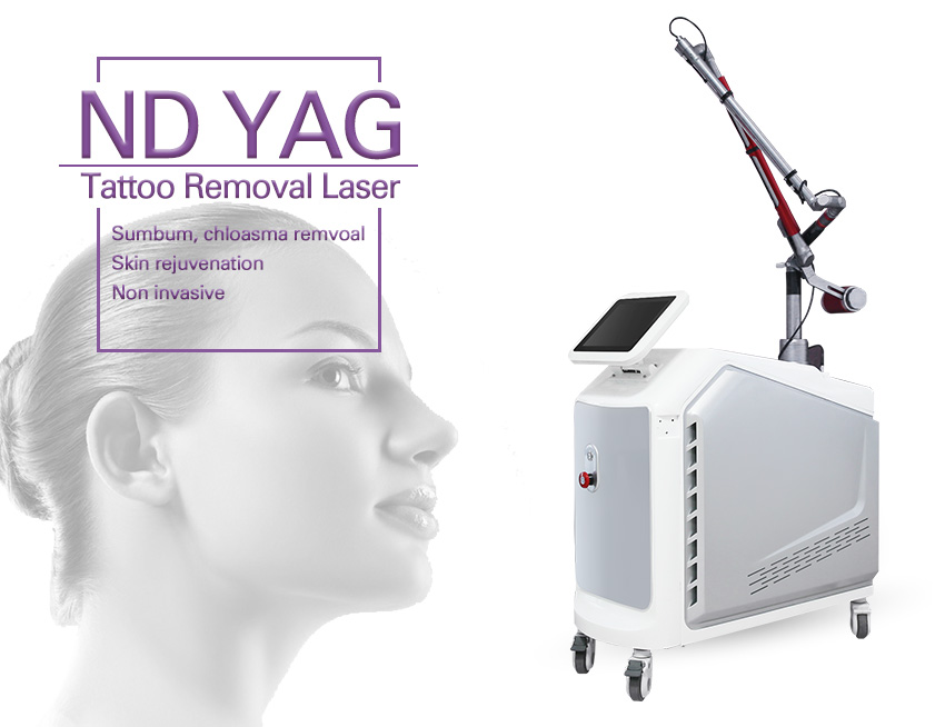 Affordable Laser Tattoo Removal Machine Buy Tattoo removal machine
